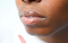 How to Prevent Chapped Lips