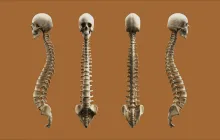 Prevention and Management of Osteoporosis