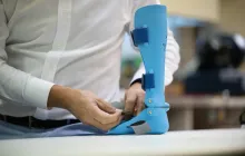 The Role of 3D Printing in Custom Prosthetics