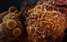 The Role of Chemotherapy in Metastatic Cancer